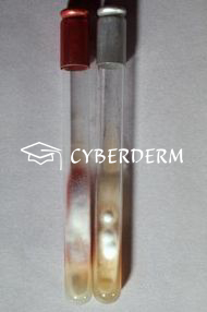 Dermatophytosen