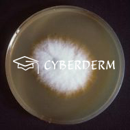 Dermatophytosen