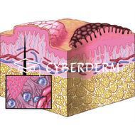 Papel (Knoetchen)