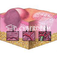 Cicatrix (Narbe)